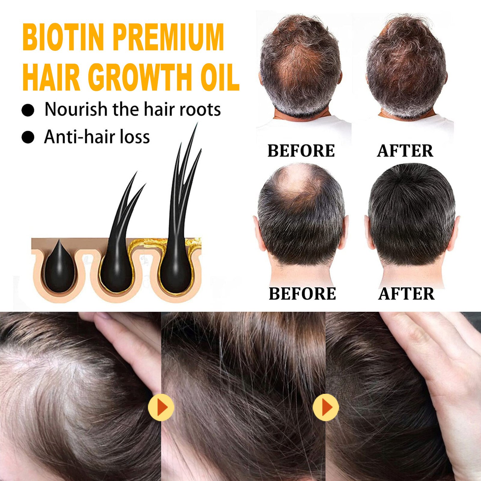 EELHOE Biotin Hair Treatment Oil Deeply Moisturizing Scalp Massage Treatment Thick And Smooth Hair Care Oil 6 EELHOE Biotin Hair Treatment Oil Deeply Moisturizing Scalp Massage Treatment Thick And Smooth Hair Care Oil - Image 6