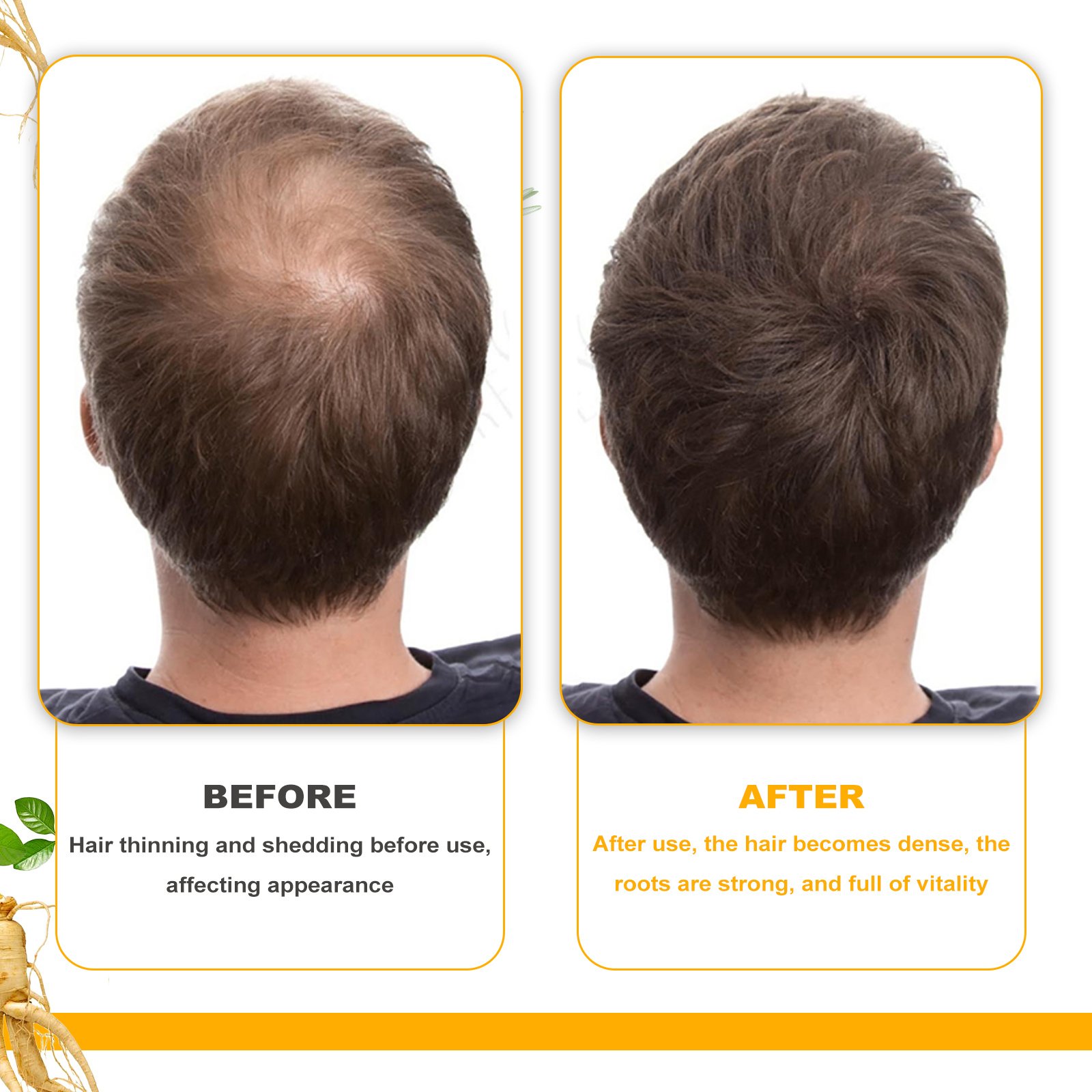 EELHOE Biotin Hair Treatment Oil Deeply Moisturizing Scalp Massage Treatment Thick And Smooth Hair Care Oil 4 EELHOE Biotin Hair Treatment Oil Deeply Moisturizing Scalp Massage Treatment Thick And Smooth Hair Care Oil - Image 4
